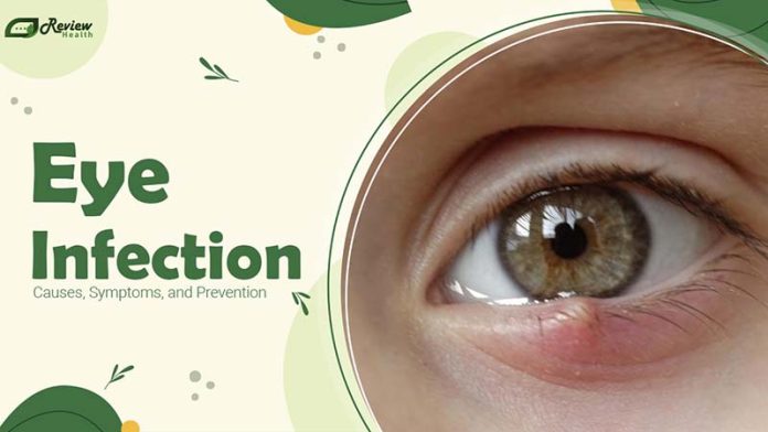 Eye Infection: Causes, Symptoms, and Prevention