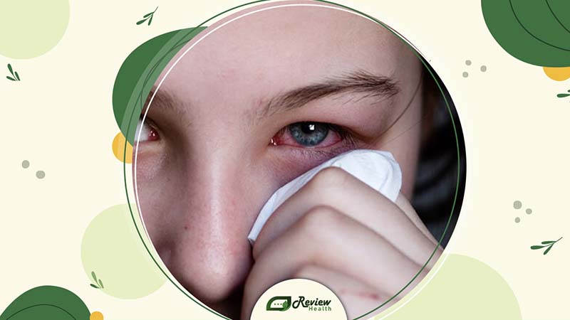 What Causes Itchy Eyes?